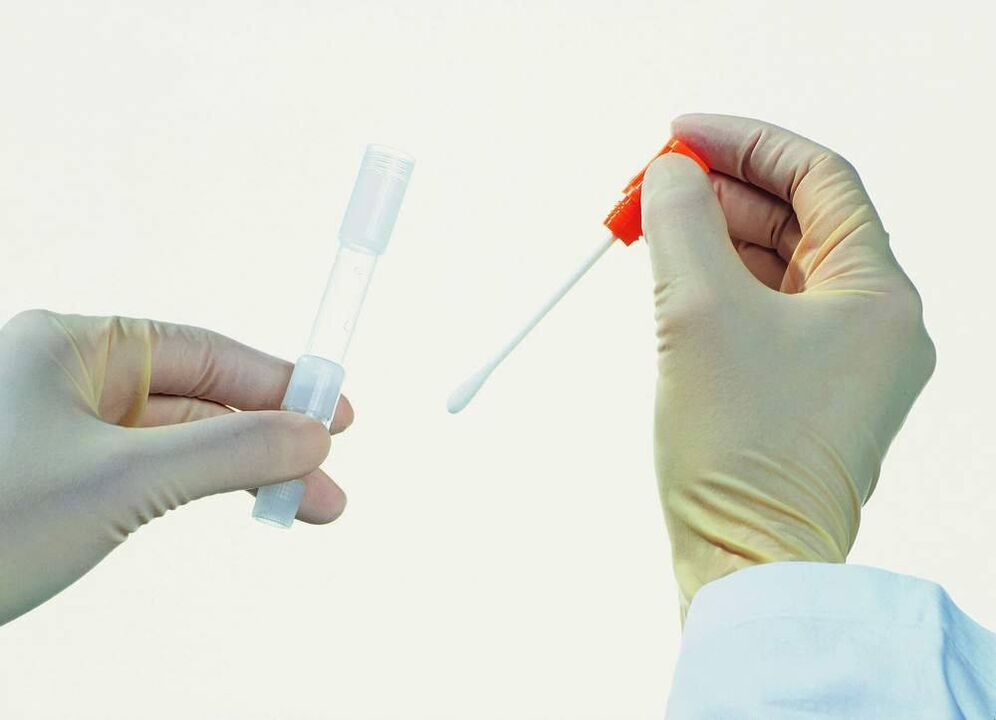 Sbírání testů k detekci chronické prostatitidy